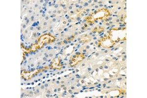 Immunohistochemistry (Paraffin-embedded Sections) (IHC (p)) image for anti-Retinol Binding Protein 4, Plasma (RBP4) antibody (ABIN7075409)