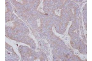 Image no. 1 for anti-SET and MYND Domain Containing 3 (SMYD3) (AA 21-416) antibody (ABIN1501007) (SMYD3 antibody  (AA 21-416))