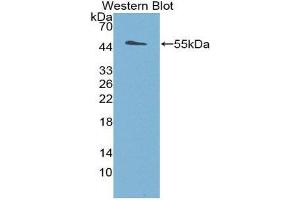 Western Blotting (WB) image for anti-Deiodinase, Iodothyronine, Type III (DIO3) (AA 11-277) antibody (ABIN1858638) (DIO3 antibody  (AA 11-277))