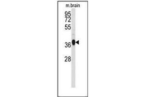 Western blot analysis of GNAO1 Antibody (C-term) Cat. (G Protein alpha 0 (AA 299-328), (C-Term) antibody)