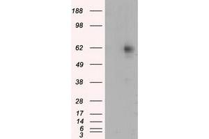 Western Blotting (WB) image for anti-Resistance To Inhibitors of Cholinesterase 8 Homolog A (C. Elegans) (RIC8A) antibody (ABIN1500704) (RIC8A antibody)