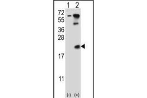 Western blot analysis of UBE2B (arrow) using rabbit polyclonal UBE2B Antibody  (ABIN388848 and ABIN2839152).