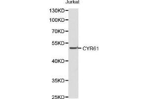 Western blot analysis of Jurkat cell lysate using CYR61 antibody.