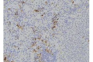 ABIN6273231 at 1/100 staining Human lymph node tissue by IHC-P. (DPP4 antibody  (C-Term))