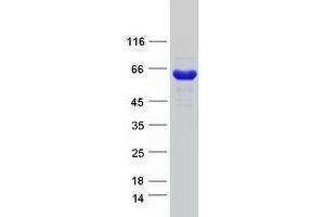 Validation with Western Blot (CTPS2 Protein (Transcript Variant 2) (Myc-DYKDDDDK Tag))
