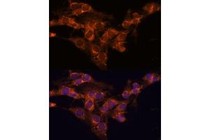 Immunofluorescence analysis of C6 cells using TMED2 antibody (ABIN7270943) at dilution of 1:100. (TMED2 antibody  (AA 60-170))