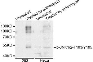 Western blot analysis of extracts of various cell lines, using Phospho-JNK1/2-T183/Y185 antibody. (JNK1/2 antibody  (pThr183, pTyr185))