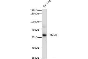 Western blot analysis of extracts of Rat lung using ZGPAT Polyclonal Antibody at dilution of 1:1000. (ZGPAT antibody)