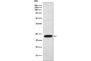 Western blot analysis of Troponin I fast skeletal muscle expression in Human skeletal muscle lysate.