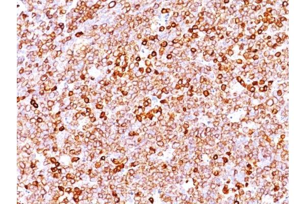 CD79a antibody  (AA 202-216)