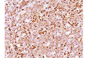 Formalin-fixed, paraffin-embedded human Tonsil stained with CD79a Mouse Monoclonal Antibody (JCB117 + HM47/A9). (CD79a antibody  (AA 202-216))