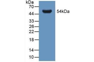 Detection of Recombinant GLTP, Human using Polyclonal Antibody to Glycolipid Transfer Protein (GLTP) (GLTP antibody  (AA 2-209))