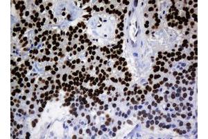 Image no. 1 for anti-Zinc Finger and SCAN Domain Containing 18 (ZSCAN18) antibody (ABIN1501861) (ZSCAN18 antibody)