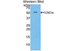Western Blotting (WB) image for anti-Integrin, alpha 6 (ITGA6) (AA 903-1073) antibody (ABIN1859489)