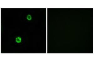 Immunofluorescence analysis of MCF-7 cells, using CST1 antibody.