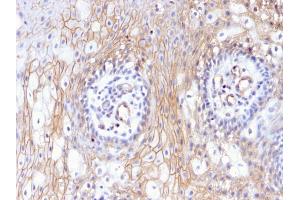 Formalin-fixed, paraffin-embedded human Tongue stained with CD59 Mouse Monoclonal Antibody (MACIF/629). (CD59 antibody)