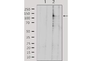 anti-serologically Defined Colon Cancer Antigen 1 (SDCCAG1) (C-Term) antibody