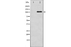 Western blot analysis of NMDAR1 phosphorylation expression in A549 whole cell lysates,The lane on the left is treated with the antigen-specific peptide. (GRIN1/NMDAR1 antibody  (pSer890))