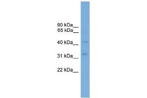 Human HT1080; WB Suggested Anti-ALS2CR4 Antibody Titration: 0.