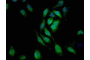 Immunofluorescent analysis of A549 cells using ABIN7161199 at dilution of 1:100 and Alexa Fluor 488-congugated AffiniPure Goat Anti-Rabbit IgG(H+L) (L1CAM antibody  (AA 995-1119))