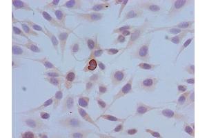 Immunocytochemistry analysis of Hela cells using ABIN7139614 at dilution of 1:100 (HIST1H3A antibody  (pSer10))
