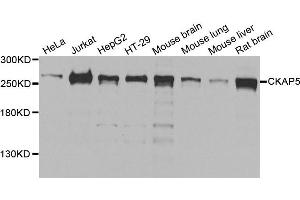 Western blot analysis of extracts of various cells, using CKAP5 antibody. (CKAP5 antibody)