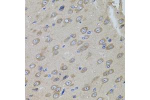 Immunohistochemistry of paraffin-embedded rat brain using SUMO3 antibody (ABIN5971585) (40x lens). (SUMO3 antibody)