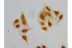 Immunocytochemistry analysis of Hela cells using ABIN7139178 at dilution of 1:100 (HIST1H2AG antibody  (acLys36))