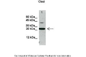 Lanes:   20 ug U937 cell lysate  Primary Antibody Dilution:   1:1000  Secondary Antibody:   Anti-rabbit HRP  Secondary Antibody Dilution:   1:2000  Gene Name:   Ctsd  Submitted by:   Ewelina Swiderek, Institute of Immunology and Experimental Therapy, Wroclaw, Poland (Cathepsin D antibody  (C-Term))