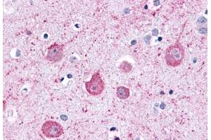 Anti-LPHN2 antibody  ABIN1049026 IHC staining of human brain, neurons and glia.