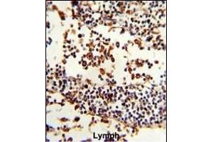 Formalin-fixed and paraffin-embedded human Lymph reacted with IGHA1 Antibody (C-term), which was peroxidase-conjugated to the secondary antibody, followed by DAB staining. (IGHA1 antibody  (C-Term))