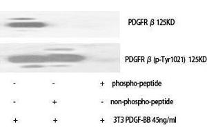 Western Blotting (WB) image for anti-Platelet Derived Growth Factor Receptor beta (PDGFRB) (Thr220) antibody (ABIN3178045) (PDGFRB antibody  (Thr220))