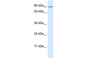 Human Lung; WB Suggested Anti-ZNF537 Antibody Titration: 0. (TSHZ3 antibody  (Middle Region))