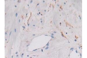Immunohistochemistry (IHC) image for anti-Legumain (LGMN) (AA 18-433) antibody (ABIN7435007)