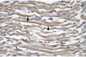 Immunohistochemical staining (Formalin-fixed paraffin-embedded sections) of human muscle with DLX2 polyclonal antibody  at 4-8 ug/mL working concentration. (DLX2 antibody  (N-Term))