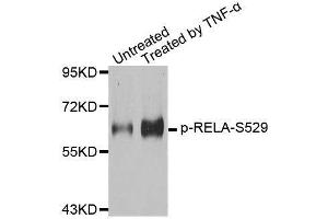 Western blot analysis of extracts from 293 cells, using Phospho-RELA-S529 antibody (ABIN2987626). (NF-kB p65 antibody  (pSer529))
