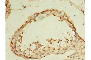 Immunohistochemistry of paraffin-embedded human testis tissue using ABIN7164351 at dilution of 1:100 (DDX31 antibody  (AA 560-851))