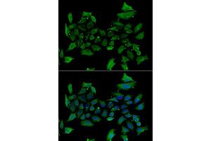Immunofluorescence analysis of HeLa cell using ALAS1 antibody. (ALAS1 antibody)