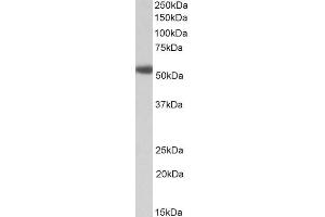 ABIN5539920 (1µg/ml) staining of Human Prostate lysate (35µg protein in RIPA buffer). (alpha 1 Adrenergic Receptor antibody  (C-Term))