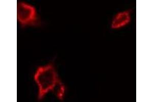 ABIN6277587 staining Hela by IF/ICC. (MERTK antibody  (Internal Region))
