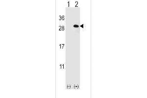 Western blot analysis of EIF4E2 using rabbit polyclonal EIF4E2 Antibody using 293 cell lysates (2 ug/lane) either nontransfected (Lane 1) or transiently transfected (Lane 2) with the EIF4E2 gene.