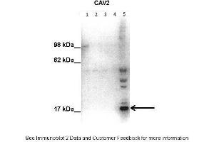 Lanes:   Lane1: 50 ug human placental tissue lysate Lane2: 40 ug human placental tissue lysate Lane3: 30 ug human placental tissue lysate Lane4: 20 ug human placental tissue lysate Lane5: 20 ug human myometrial tissue lysate  Primary Antibody Dilution:   1:500  Secondary Antibody:   Goat anti-rabbit HRP  Secondary Antibody Dilution:   1:10000  Gene Name:   Caveolin 2  Submitted by:   Hiten Mistry, Ania Czajka and Marta Hentschke Ribeiro, King's College London (Caveolin 2 antibody  (N-Term))