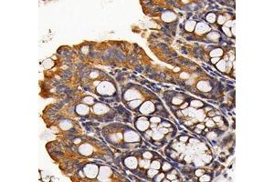 Immunohistochemistry of paraffin embedded mouse colon using RAB21 (ABIN7075341) at dilution of 1: 700 (400x lens) (RAB21 antibody)