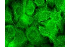 Immunocytochemistry/Immunofluorescence analysis using Mouse Anti-TrpV3 Monoclonal Antibody, Clone S15-39 (ABIN2485246). (TRPV3 antibody  (AA 458-474) (PerCP))