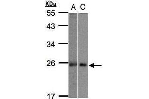 WB Image Sample(30 ug whole cell lysate) A:293T B:Hep G2 , 12% SDS PAGE antibody diluted at 1:1000 (m1ip1 antibody)