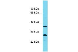Western Blotting (WB) image for anti-Protein Tyrosine Phosphatase, Non-Receptor Type 20A (PTPN20A) (Middle Region) antibody (ABIN2791465) (PTPN20A antibody  (Middle Region))
