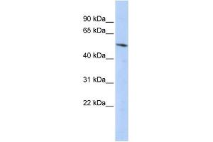 Western Blot showing BCL6B antibody used at a concentration of 1-2 ug/ml to detect its target protein. (BCL6B antibody  (Middle Region))