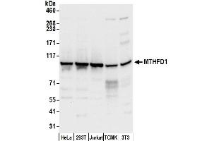 anti-Methylenetetrahydrofolate Dehydrogenase (NADP+ Dependent) 1, Methenyltetrahydrofolate Cyclohydrolase, Formyltetrahydrofolate Synthetase (MTHFD1) (AA 150-200) antibody