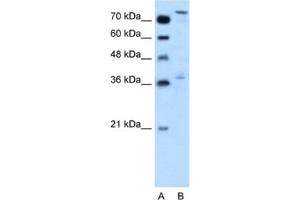 Western Blotting (WB) image for anti-Nuclear Factor (erythroid-Derived 2)-Like 3 (NFE2L3) antibody (ABIN2460792) (NFE2L3 antibody)