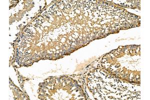 ABIN6261535 and ABIN6276460 at 1/100 staining Rat testis tissue by IHC-P. (ENO1 antibody  (C-Term))